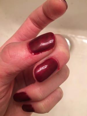 Really painful bleeding cuticles :(