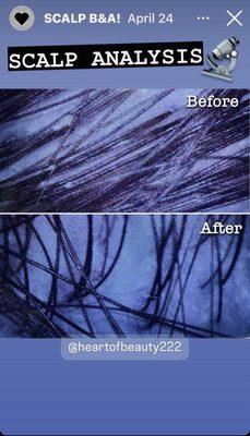 Scalp and hair analysis before and after