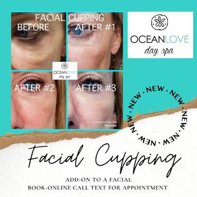 FACIAL CUPPING promotes Lymph Drainage and Circulation.  Add-on to your facial to experience these added benefits.