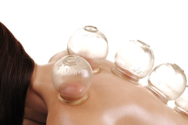 Cupping