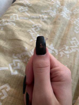 Peeling nail