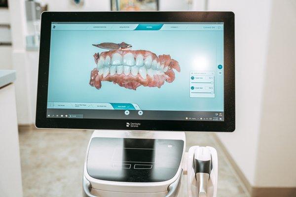 Intraoral scanning for clear aligners. Consultations are free.