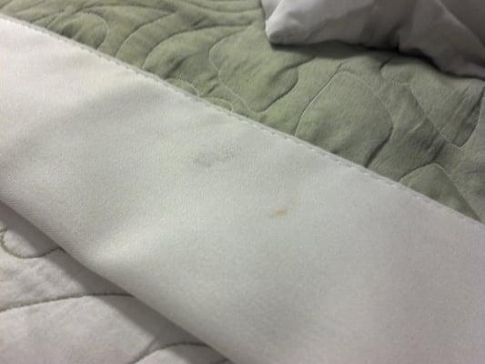 Dirty sheets. This is where our faces would be when sleeping.