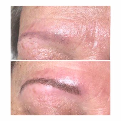 Microblading