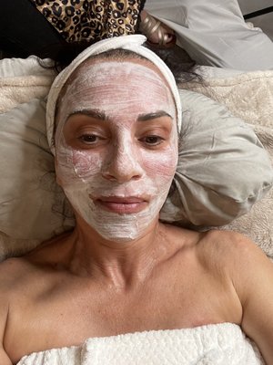 Another relaxing mask applied to my face during my micro needling session