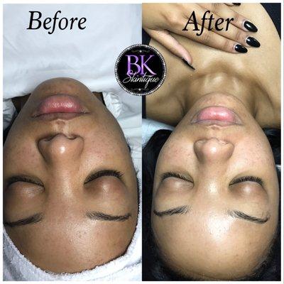 Customized facial