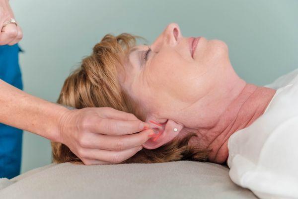 Auricular "ear" acupuncture for pain, weightloss, addiction recovery, sleep, headaches and more!