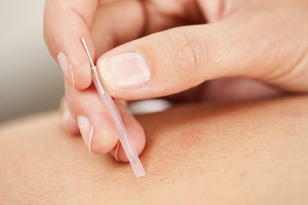 Better Health Acupuncture & Chinese Medicine