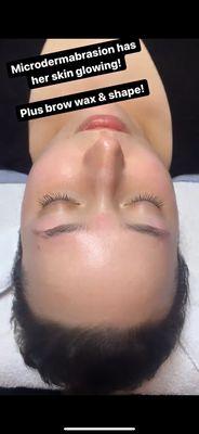 Eyebrow shaping and wax, microdermabrasion with advanced facial done by Skin.IsIn.WithLexi