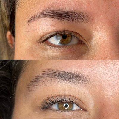 Microneedling for eyebrows is a perfect method for boosting your brow growth naturally.