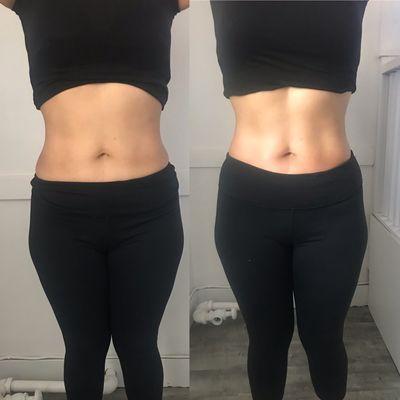 Body sculpting, wow look at those results contact Amanda give us a call