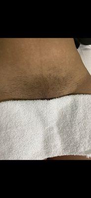 Before a Brazilian wax