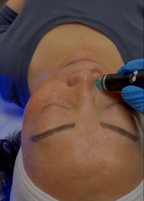 Hydrafacial