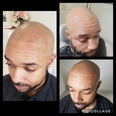 Scalp micropigmentation Las Vegas!