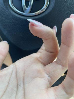 Cut my skin from filing my nails too hard