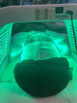 LED LIGHT THERAPY AFTER AN ADVANCED TREATMENT. GREEN LIGHT  THERAPY TARGETS HYPERPIGMENTATION AND SLOWS DOWN THE PRODUCTION OF MELANIN.