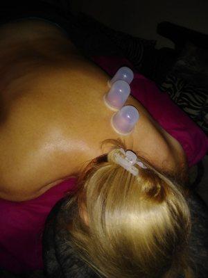 Cupping..very effective for relieving tight muscles