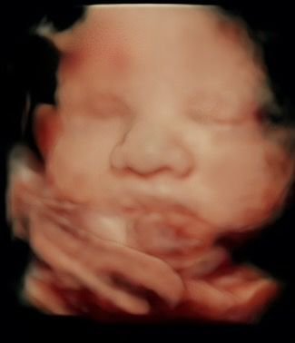 Desired Dream | 3D 4D HD Live Ultrasound