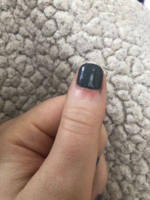 Cut around cuticle from gel manicure