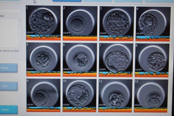 Monitoring and selecting embryos like no other center in the region with the EmbryoScope Time-Lapse system.