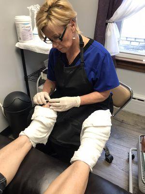 Waterless pedicures for diabetics/at risk