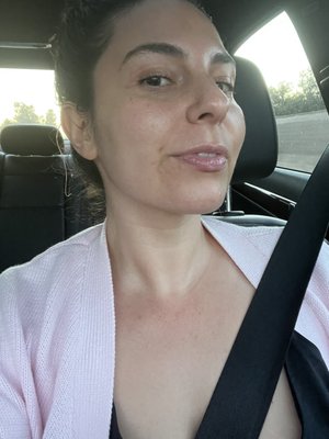 My jaw line was super defined after her facial cupping treatment.