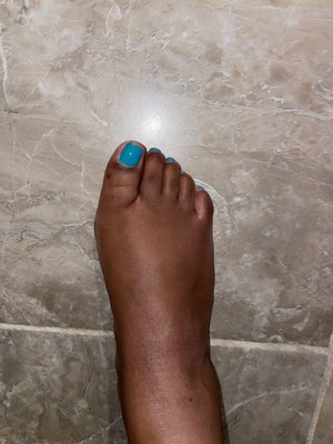 Pedicure results