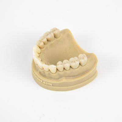 Zirconia Crown & Bridge