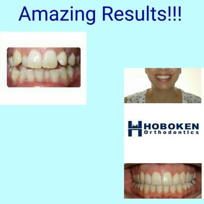 Dr. Feibish  and Dr. Sandman are the best!!!! They have an amazing staff and they truly care. Thanks Hoboken  Orthodontics.