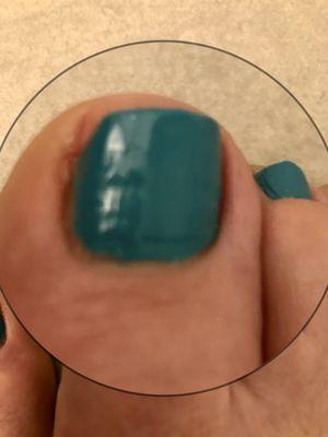 Nail edge cut improperly which exposed the skin normally covered by my nail.