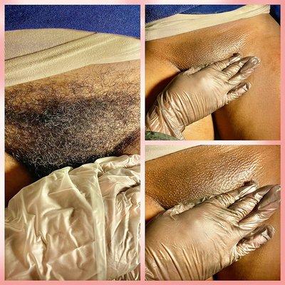 Brazilian Wax