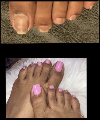 We offer Acrylic Toes.