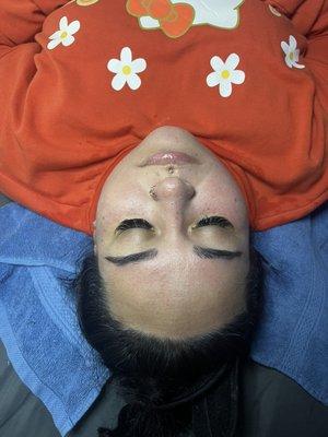 After photo of a Deep Pore Cleansing Facial