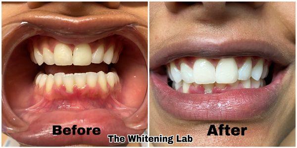 The 20min Whitening Lab. We GUARANTEE results!