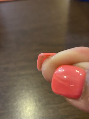 Lifted nail. Old not removed