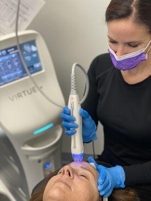 RF Microneedling treatments helps tighten the skin, decrease pore size, minimize acne scarring, and give your skin a rejuvenated look.