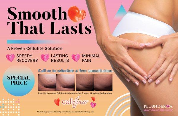 We proudly offer Cellfina®, a proven cellulite solution.