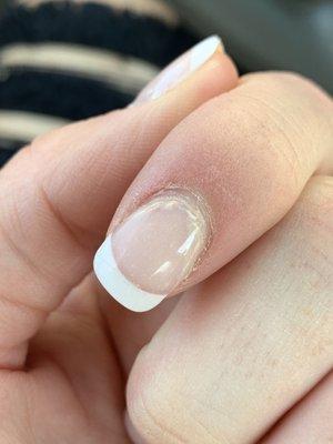 Cracked nail, "filled in" 6 days ago. Top coat peeling off.