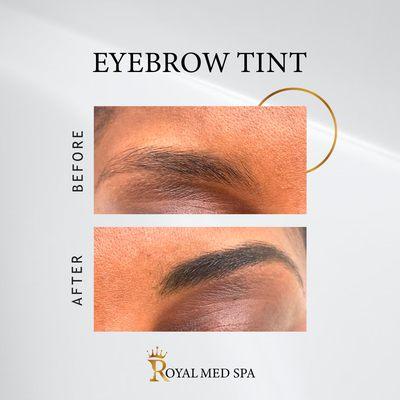 The eyebrow tint services at Royal Med Spa is done to the eyebrow area