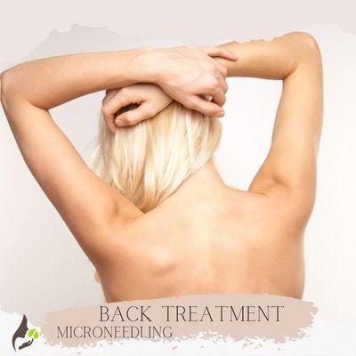 Back Treatment Microneedling