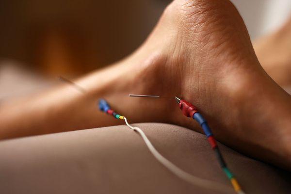 We also offer electrostimulation.