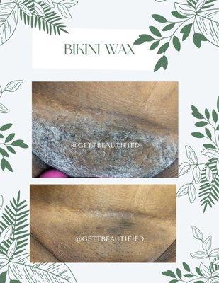 Before & After Bikini Wax