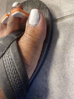 Worst pedicure