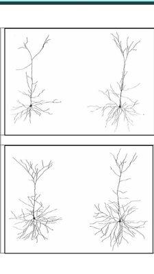 Three month results in the neuron and dendrite functioning after three months supplementation on Empowerplus Q96.