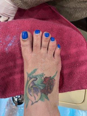 Here is my before photo of my krusty musty toes that needed help!