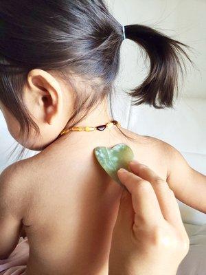 Gua Sha releases internal heat. Especially beneficial for children coming down with a cold.