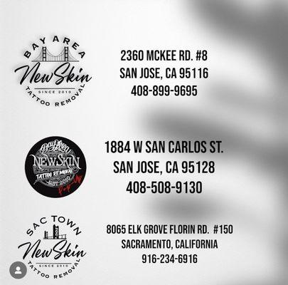 New Skin Tattoo Removal Sactown