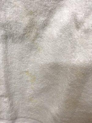 Another disgusting, stained, dirty towel