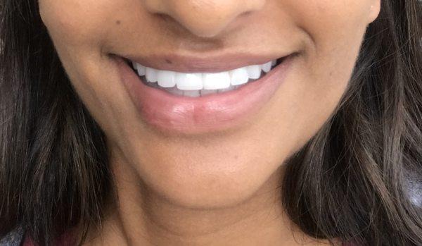 Lalitha N. Kothuri, DDS