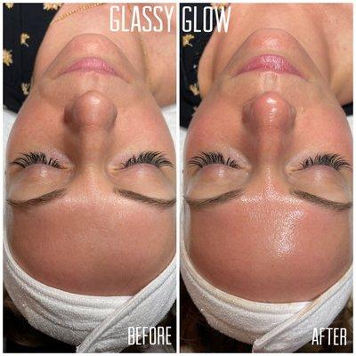 Glassy Glow Treatment. Glow lasts up to 7 days.